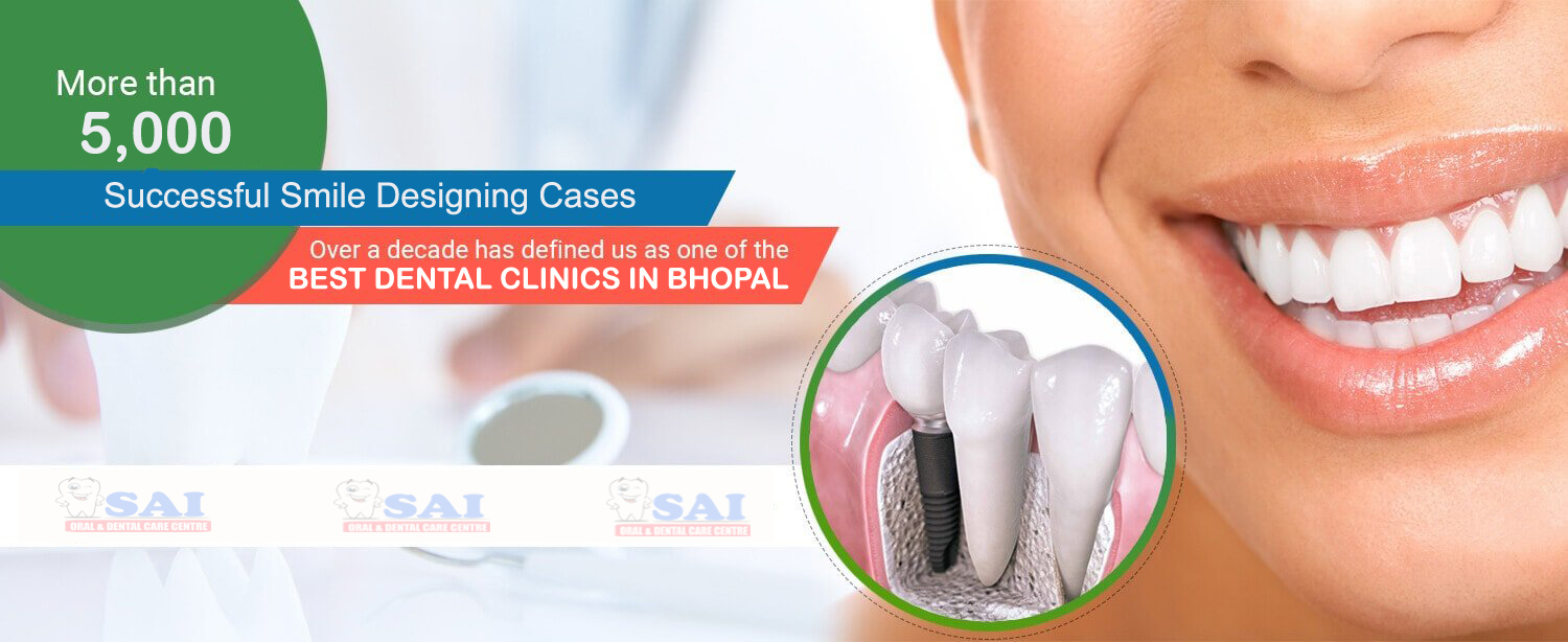 slider image 3 Sai Dental Clinics Bhopal
